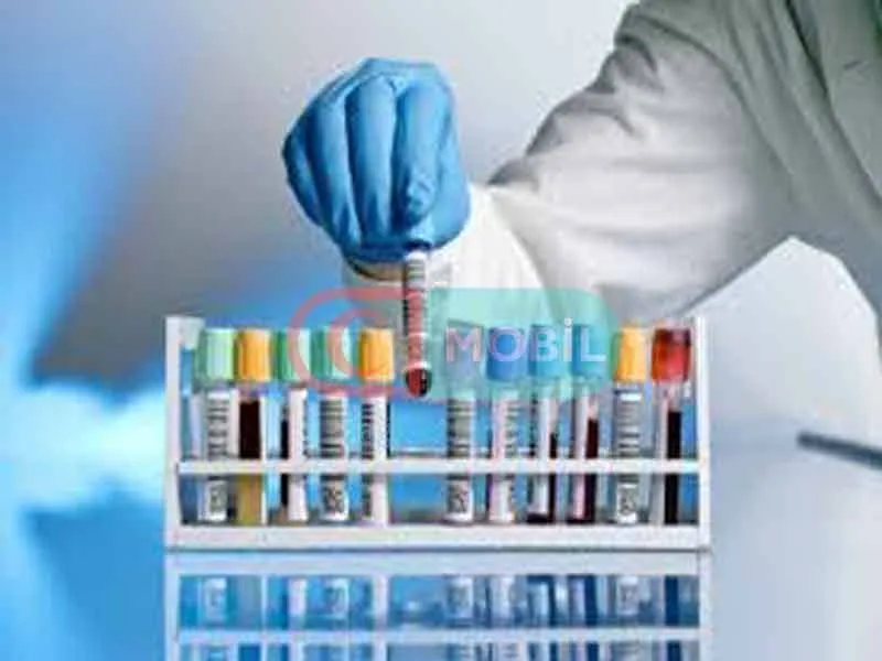Solunum Fonksiyon Testi